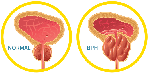 ProstateImages 1