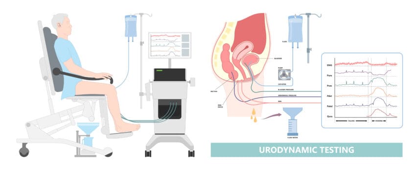 Urodynamics Testing For Bladder Function | North Texas | UPNT
