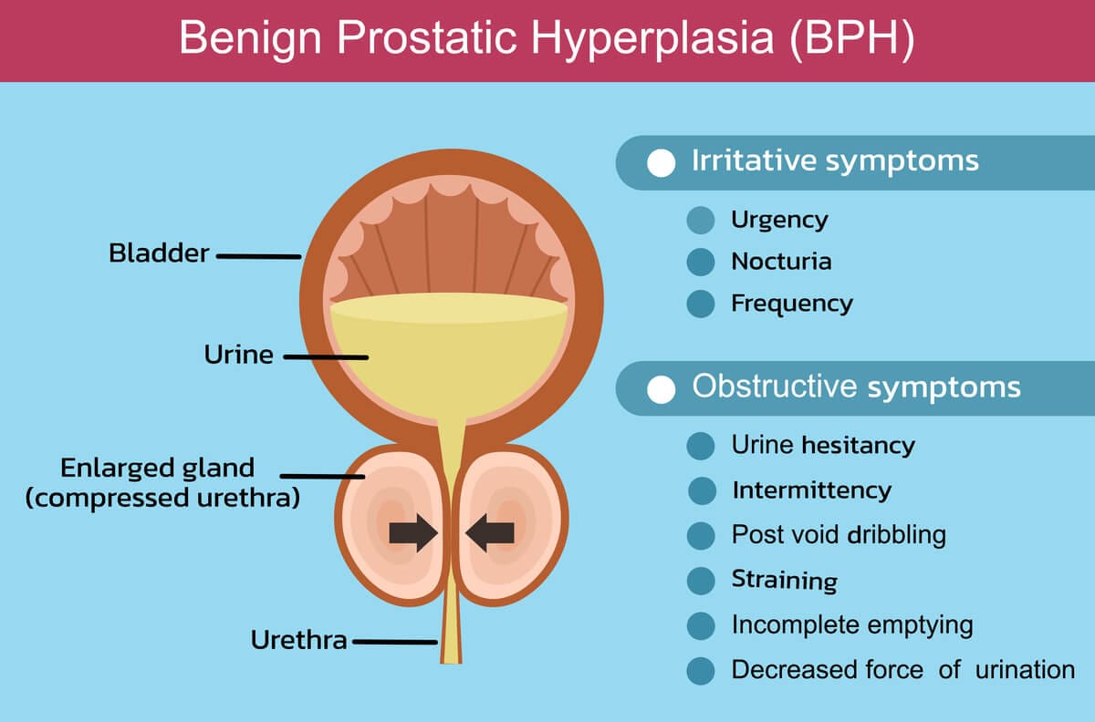 bph-and-oab-1-1