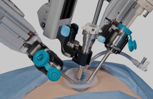 single-port-robotic-surgery-cutting-edge-innovation