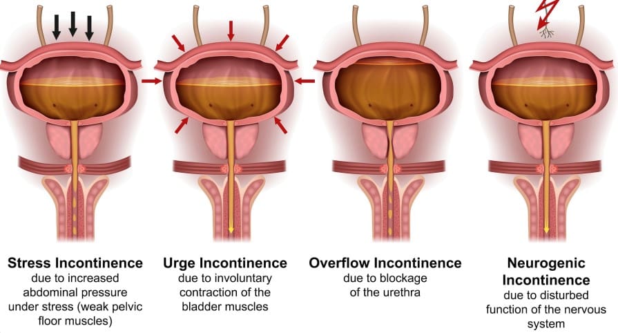 what-is-male-urinary