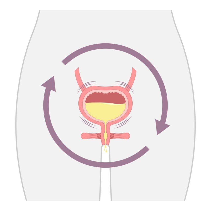 Women's OAB & Urge Incontinence Treatment | Dallas | UPNT